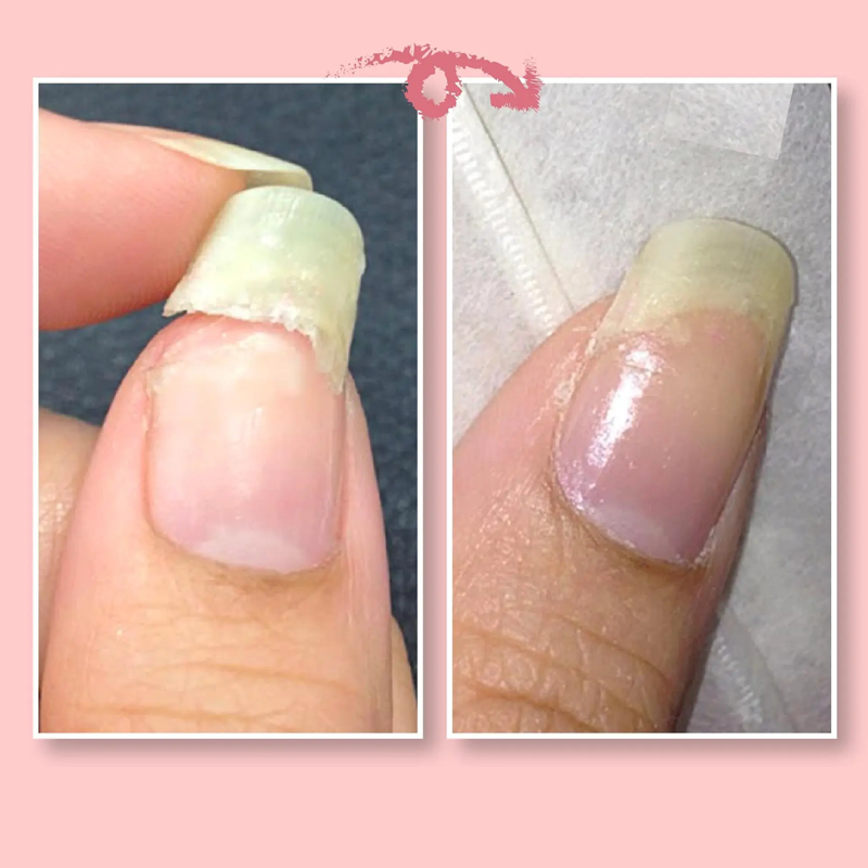 (1 + 1 Free) Nail Rescue Repair Gel