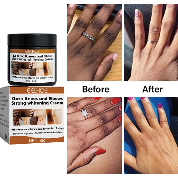 Dark Knuckles Fast Whitening Cream - beumoonshop