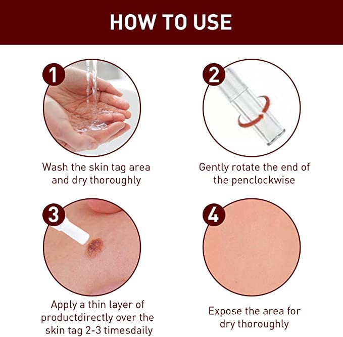 🔥Last Day Promotion 65% OFF🔥𝗤𝗩𝗖 recommends Tags & Moles Remover - beumoonshop