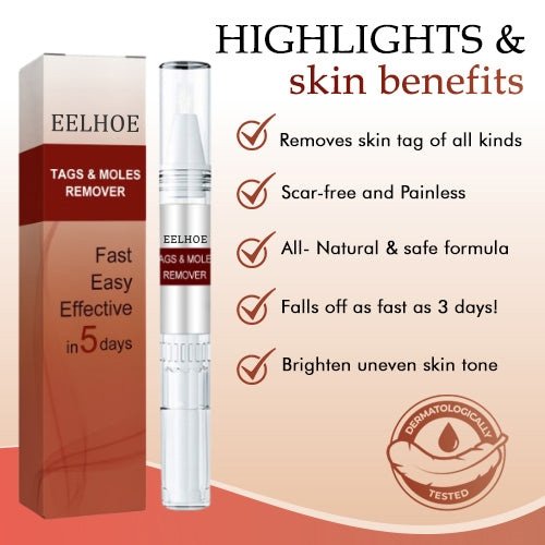 🔥Last Day Promotion 65% OFF🔥𝗤𝗩𝗖 recommends Tags & Moles Remover - beumoonshop