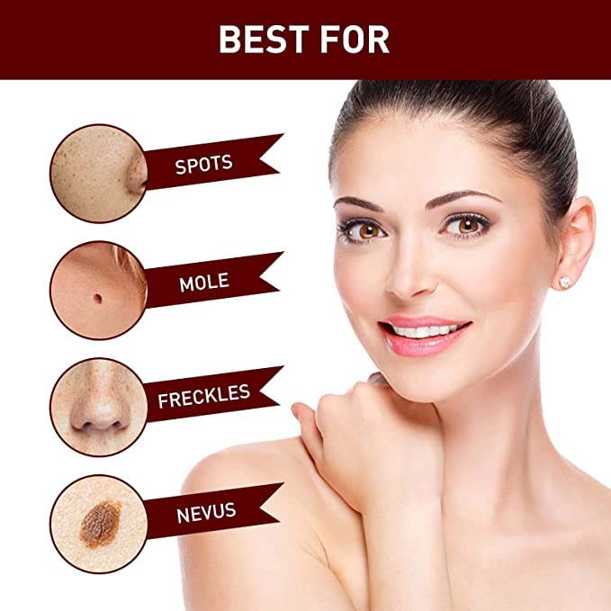 🔥Last Day Promotion 65% OFF🔥𝗤𝗩𝗖 recommends Tags & Moles Remover - beumoonshop