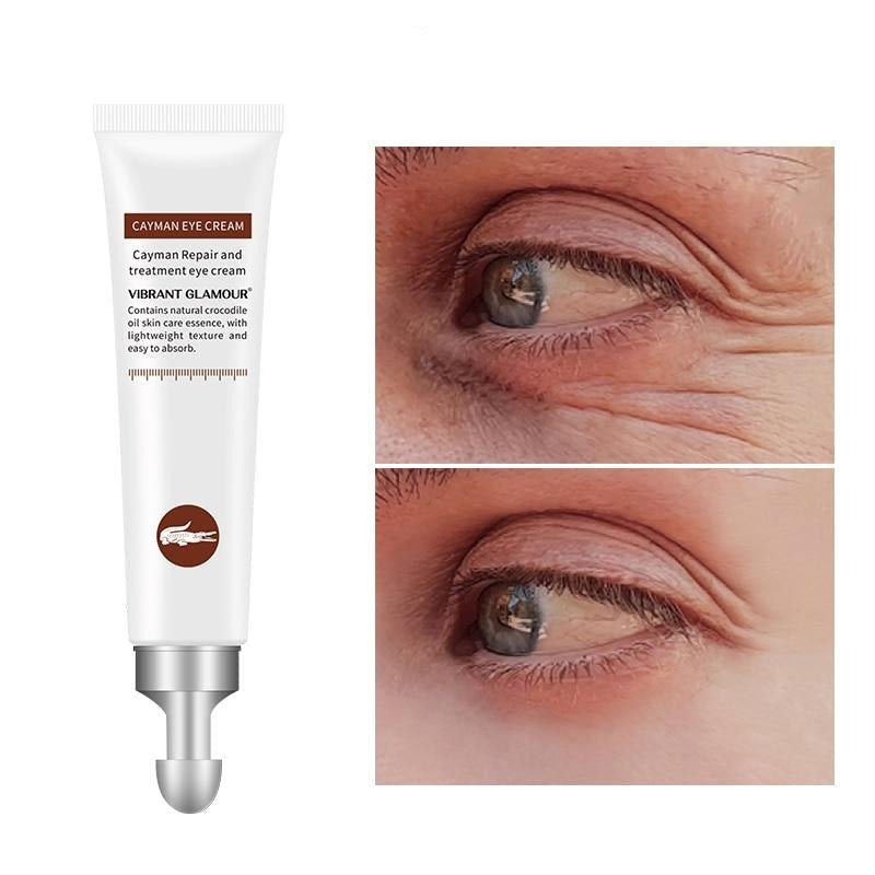 Magic Eye Cream - beumoonshop